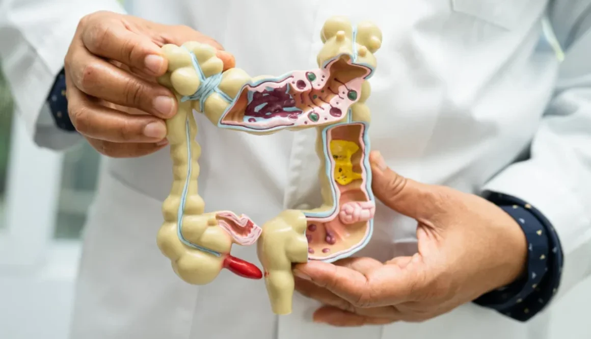 gut health pic_3 Gut Health Treatment in Dubai