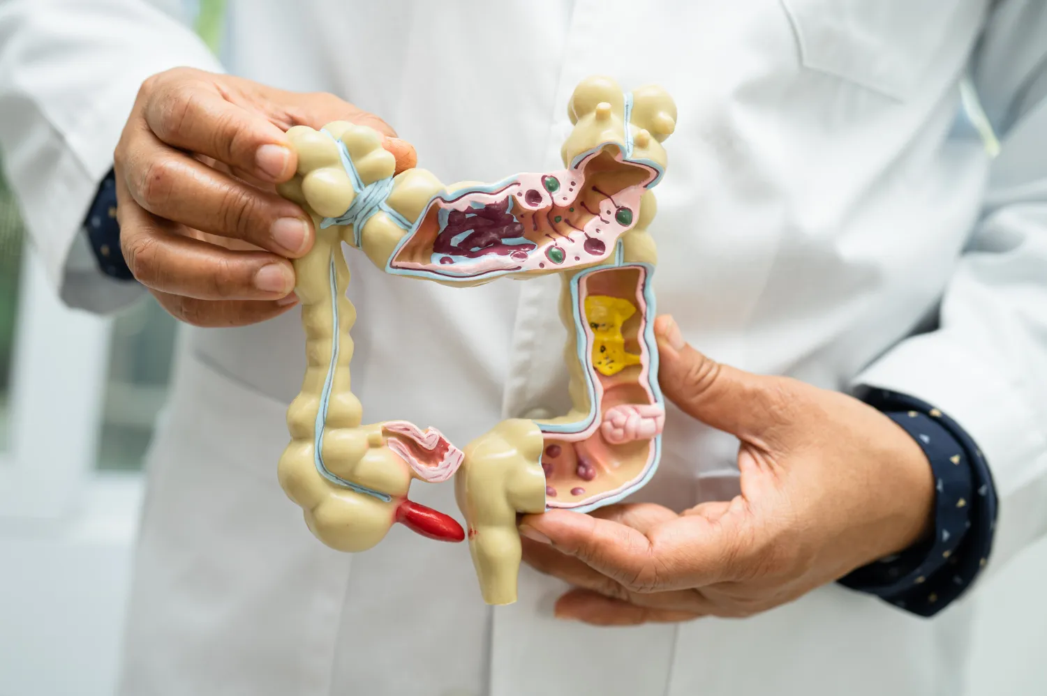 Gut Health Treatment in Dubai
