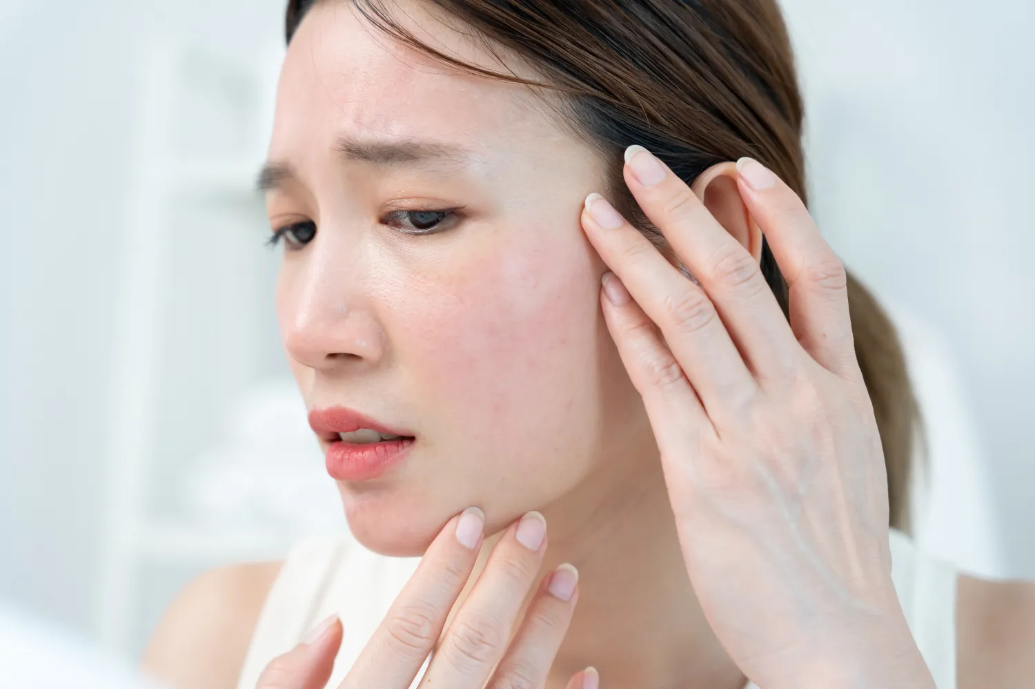 rosacea treatment in dubai
